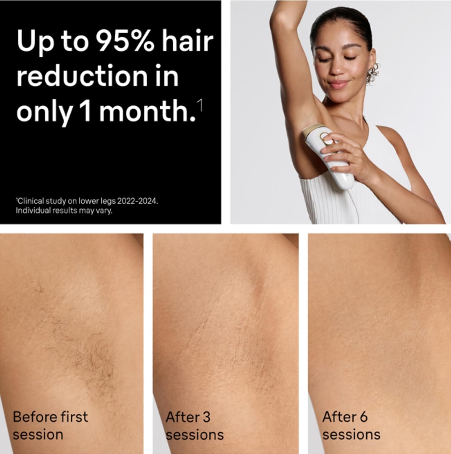 Braun IPL, Silk·Expert Pro 5, IPL Hair Removal for Women and Men, Permanent Laser Hair Reduction At-Home, 4 Heads, IPL5347